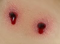 Vampire Bite