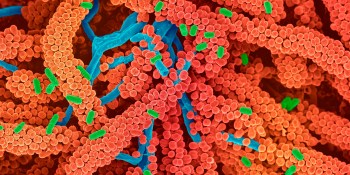 Khosla Ventures makes first investment in France, leads $18 million round in Eligo Bioscience