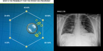 Unanimous AI achieves 22% more accurate pneumonia diagnoses