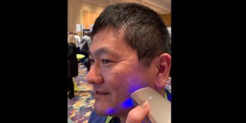 Watch Opté remove the spots on Dean Takahashi’s face