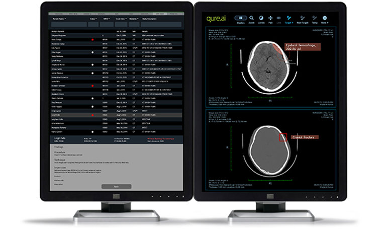 Qure.ai